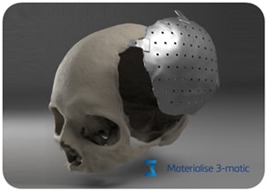 Materialise 3-Matic Medical / Research v12.0